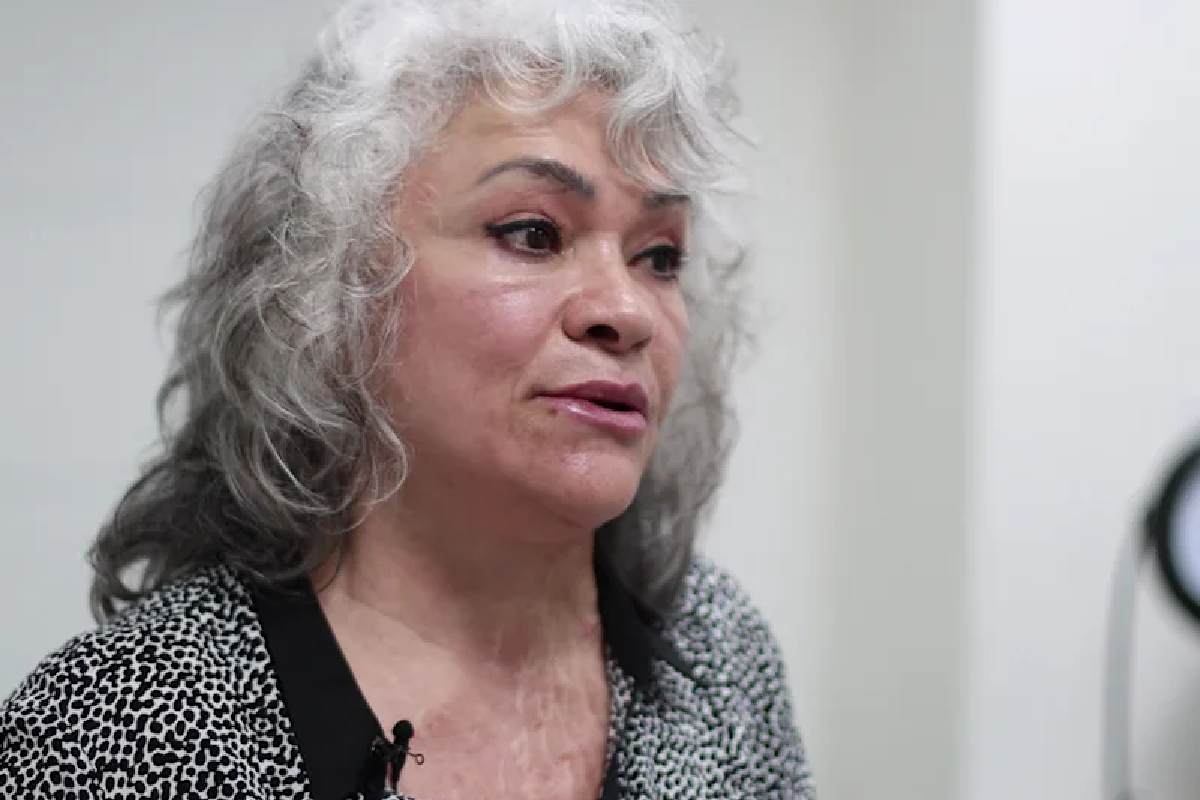 Retomar la vida tras un ataque con ácido, el largo y difícil proceso para la recuperación