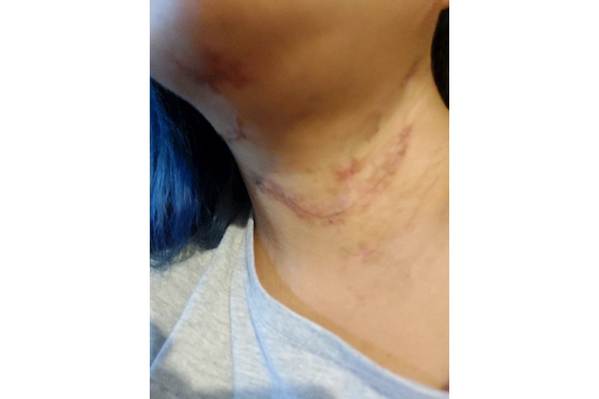 cicatrices-violencia-de-genero-mujeres-veracruz