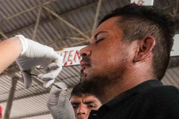 migrantes se cosen sus labios