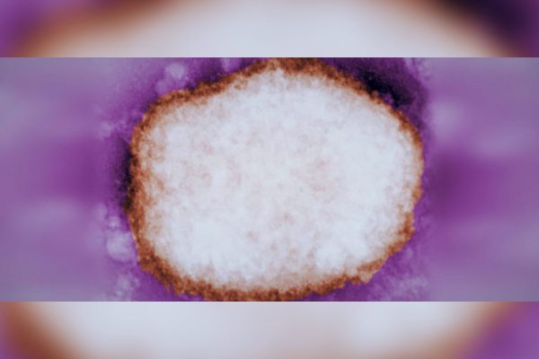 Partícula amplificada del virus de la viruela del mono