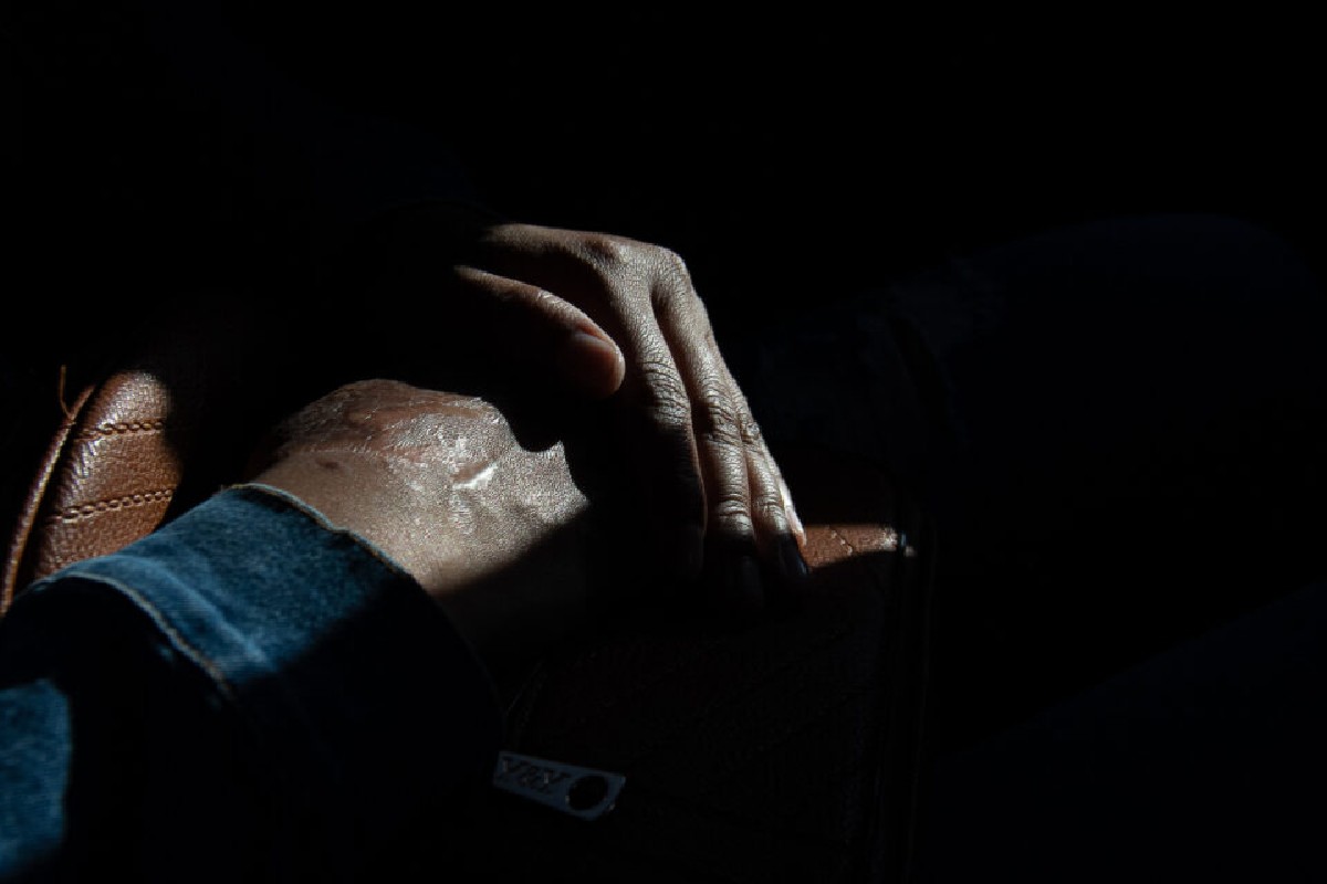 María López, el primer caso de ataque con ácido registrado en México