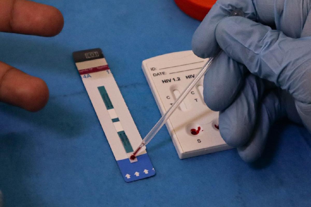 Diagnóstico tardío en casos de VIH; Red de Respuesta busca frenar brecha en prevención y atención