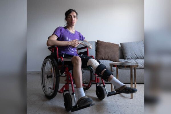 Genn se accidentó en una Uber Moto- el chofer lo abandonó, la app no le contesta y no sabe cuándo volverá a caminar_7