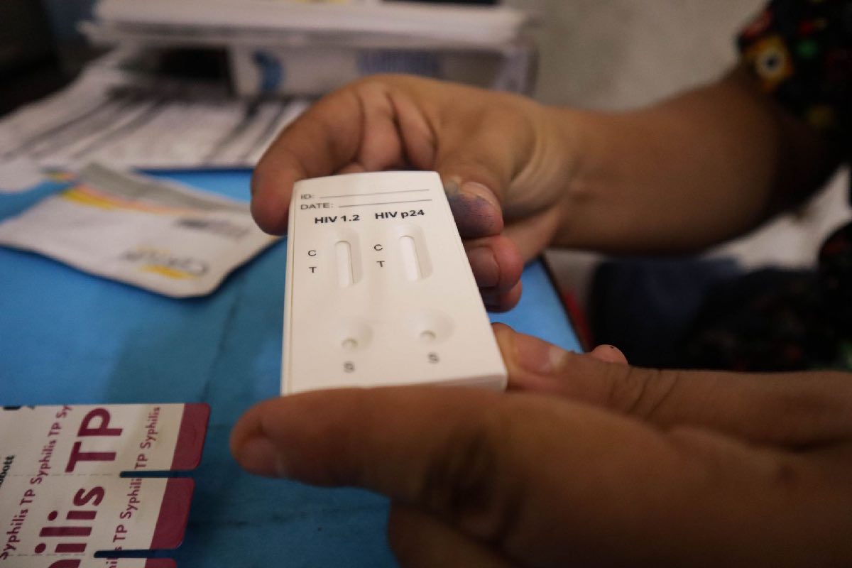 Diagnóstico tardío en 40 % de los casos de VIH; Red de Respuesta busca frenar brecha en prevención y atención