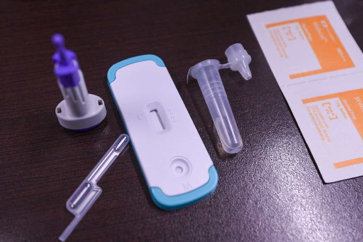 Diagnóstico tardío en 40 % de los casos de VIH; Red de Respuesta busca frenar brecha en prevención y atención