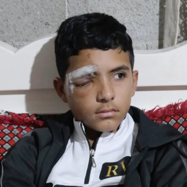 Nazih Masalma, de 14 años, esperaba el autobús escolar junto a su hermana en la villa de Beit Awwa, al sur de Hebrón, el 27 de octubre de 2025, cuando un soldado abrió la puerta de uno de los tres jeep militares que pasaban y lanzó una bomba de gas lacrimógeno directamente a su rostro. Perdió el ojo izquierdo.